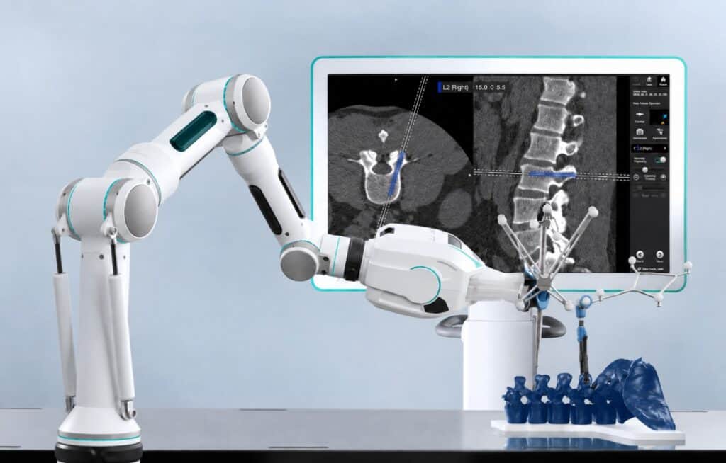 Surgical robot guiding spinal screw placement with navigation screen